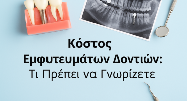 Κόστος Εμφυτευμάτων Δοντιών στην Αθήνα Ο Πλήρης Οδηγός