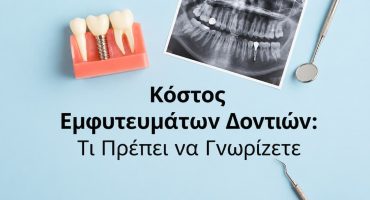 Κόστος εμφυτευμάτων δοντιών στην Αθήνα και σχεδιασμός θεραπείας