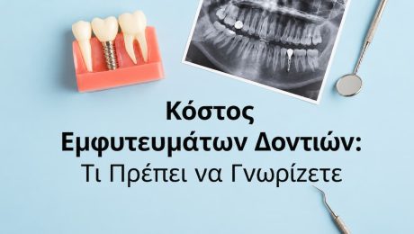 Κόστος εμφυτευμάτων δοντιών στην Αθήνα Κόστος εμφυτευμάτων δοντιών στην Αθήνα και σχεδιασμός θεραπείας
