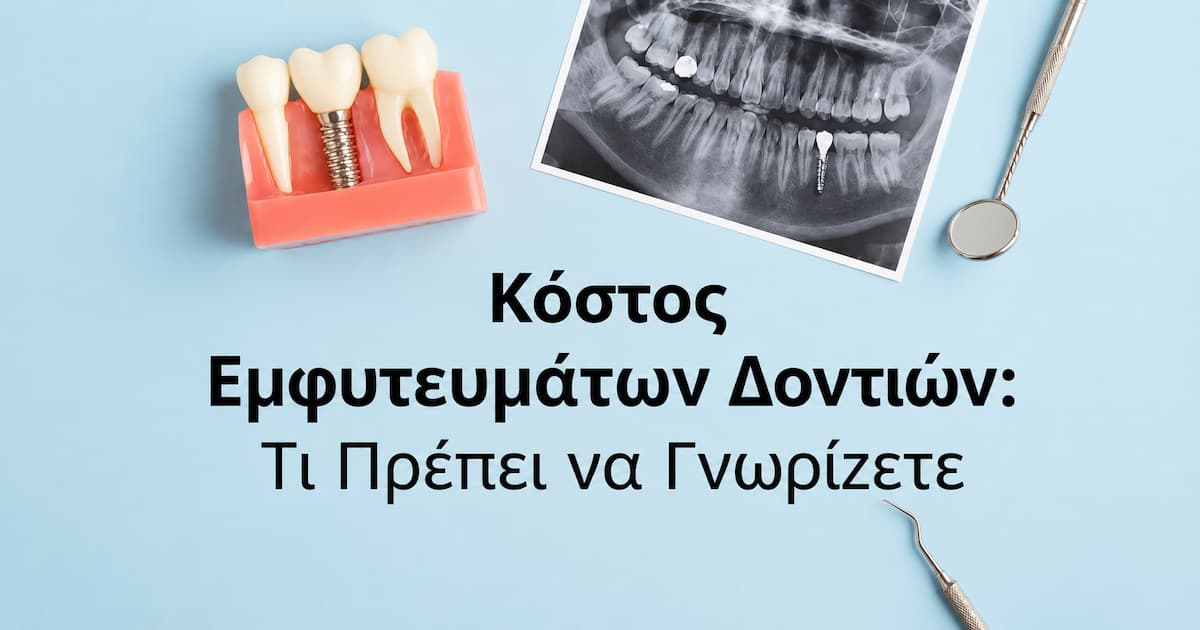 Κόστος εμφυτευμάτων δοντιών στην Αθήνα Κόστος εμφυτευμάτων δοντιών στην Αθήνα και σχεδιασμός θεραπείας